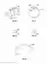 Fig. 33 - Methods and apparatus for treating vertebral fractures