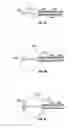 Fig. 34 - Methods and apparatus for treating vertebral fractures