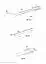 Fig. 40 - Methods and apparatus for treating vertebral fractures