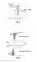 Fig. 47 - Methods and apparatus for treating vertebral fractures