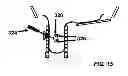 Fig. 24 - OPEN ARCHITECTURE IMAGING APPARATUS AND COIL SYSTEM FOR MAGNETIC RESONANCE IMAGING