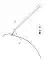 Fig. 15 - Suture snare with retractable sleeve