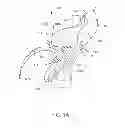 Fig. 02 - MEDICAL DEVICE AND RELATED METHODS OF USE