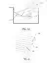 Fig. 13 - MEDICAL DEVICE AND RELATED METHODS OF USE