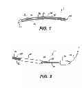 Fig. 02 - Methods for treating a gastrointestinal tract