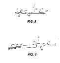 Fig. 03 - Methods for treating a gastrointestinal tract