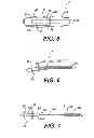 Fig. 04 - Methods for treating a gastrointestinal tract