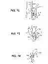 Fig. 07 - Methods for treating a gastrointestinal tract