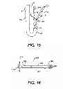 Fig. 08 - Methods for treating a gastrointestinal tract