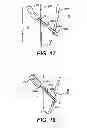Fig. 09 - Methods for treating a gastrointestinal tract