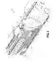 Fig. 03 - Tissue-removing catheter with rotatable cutter