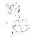 Fig. 12 - Tissue-removing catheter with rotatable cutter