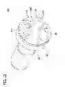 Fig. 13 - Tissue-removing catheter with rotatable cutter