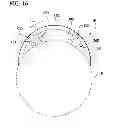 Fig. 17 - Tissue-removing catheter with rotatable cutter