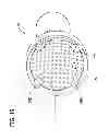Fig. 20 - Tissue-removing catheter with rotatable cutter