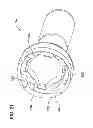 Fig. 22 - Tissue-removing catheter with rotatable cutter
