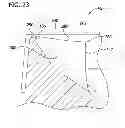 Fig. 24 - Tissue-removing catheter with rotatable cutter
