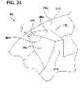 Fig. 25 - Tissue-removing catheter with rotatable cutter