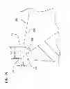 Fig. 26 - Tissue-removing catheter with rotatable cutter