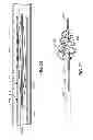 Fig. 16 - SYSTEMS, METHODS AND DEVICES FOR REMOVING OBSTRUCTIONS FROM A BLOOD VESSEL
