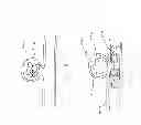Fig. 05 - IMPLANT FOR ANEURYSM TREATMENT