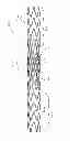 Fig. 09 - IMPLANT FOR ANEURYSM TREATMENT