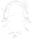 Fig. 12 - IMPLANT FOR ANEURYSM TREATMENT