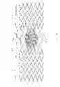 Fig. 15 - IMPLANT FOR ANEURYSM TREATMENT