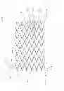 Fig. 18 - IMPLANT FOR ANEURYSM TREATMENT