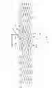 Fig. 29 - IMPLANT FOR ANEURYSM TREATMENT