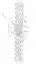 Fig. 32 - IMPLANT FOR ANEURYSM TREATMENT