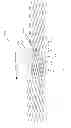 Fig. 37 - IMPLANT FOR ANEURYSM TREATMENT