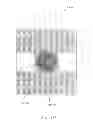 Fig. 43 - IMPLANT FOR ANEURYSM TREATMENT