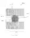 Fig. 44 - IMPLANT FOR ANEURYSM TREATMENT