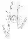 Fig. 01 - Removable anchored lung volume reduction devices and methods