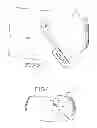 Fig. 03 - Removable anchored lung volume reduction devices and methods