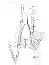 Fig. 05 - Removable anchored lung volume reduction devices and methods