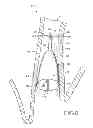Fig. 06 - Removable anchored lung volume reduction devices and methods