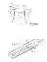 Fig. 11 - Removable anchored lung volume reduction devices and methods