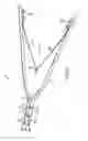 Fig. 04 - Method and Apparatus for Cutting Embolic Coils