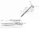Fig. 01 - Snap-on vascular closure device and methods