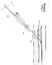 Fig. 03 - Snap-on vascular closure device and methods