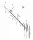 Fig. 07 - Snap-on vascular closure device and methods
