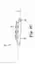 Fig. 04 - SURGICAL SYSTEM INCLUDING AN ANCHOR INSERTABLE INTO A CANNULA OF AN INTRODUCER