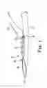 Fig. 06 - SURGICAL SYSTEM INCLUDING AN ANCHOR INSERTABLE INTO A CANNULA OF AN INTRODUCER