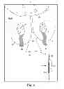 Fig. 07 - System and method of anchoring support material to tissue