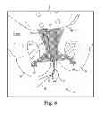 Fig. 08 - System and method of anchoring support material to tissue