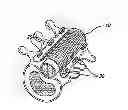 Fig. 01 - Bone anchored surgical mesh
