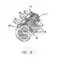 Fig. 05 - Bone anchored surgical mesh