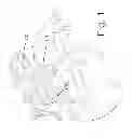 Fig. 02 - INTER-VERTEBRAL ORTHOPEDIC DEVICE PLACEMENT